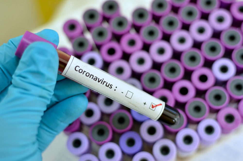 Canadian researchers cannabis coronavirus
