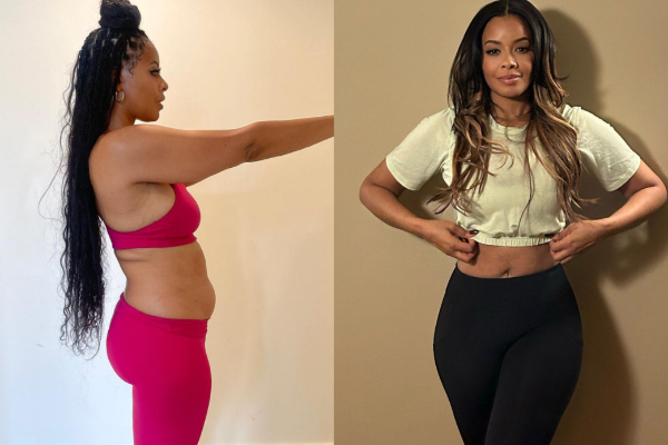 Vanessa Simmons body before and after liposuction