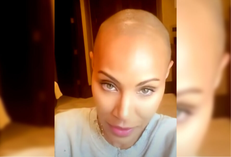 Jada Pinkett Smith shows head scar